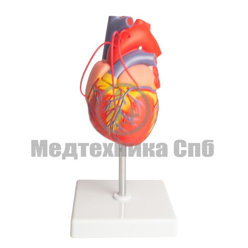 Модель сердца с шунтированием 2 части (на подставке)